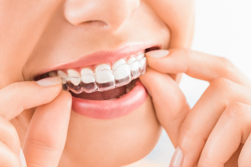 Straighten your teeth with clear aligners in Tucker, GA
